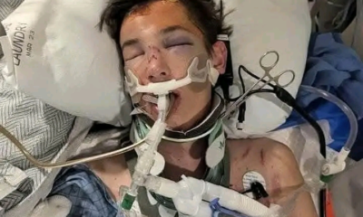 Shocking: Trevor is 17 & a senior @ Hurricane High School, he was in a horrible dirt bike accident on Sunday evening and is … See more