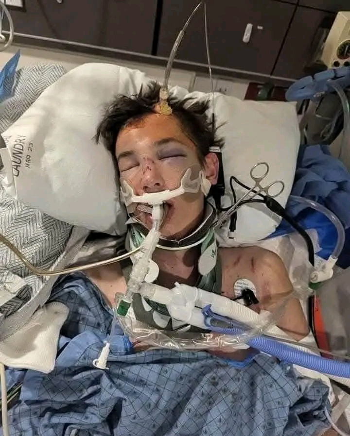 Shocking: Trevor is 17 & a senior @ Hurricane High School, he was in a horrible dirt bike accident on Sunday evening and is … See more